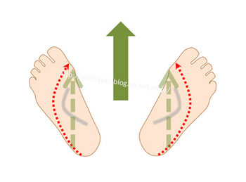 足底をハの字にして歩いてオーバープロネーションの足の動きを再現した状態