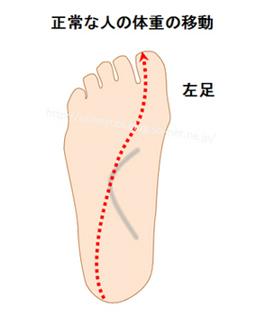 正常な足の動きをする人が走った時の足の裏の重心の移動